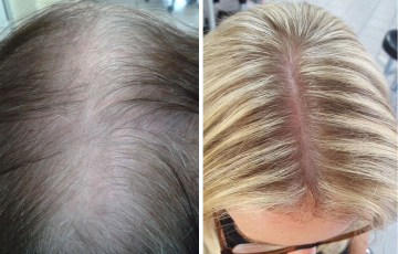 Comparison of a client before and after the Stop & Grow application